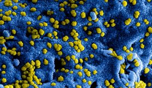 Lees meer over het artikel Verspreiding coronavirus voorkomen